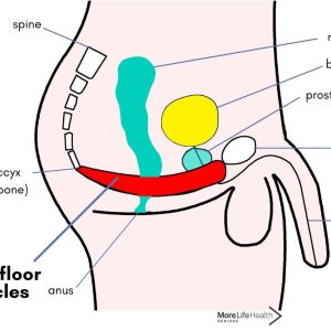 L’incontinenza urinaria post prostatectomia è una delle complicanze più comuni dopo l’intervento chirurgico di asportazione della prostata