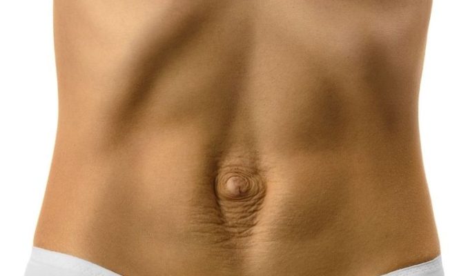 DIASTASI ADDOMINALE