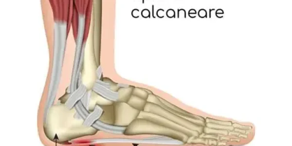 spina calcanea